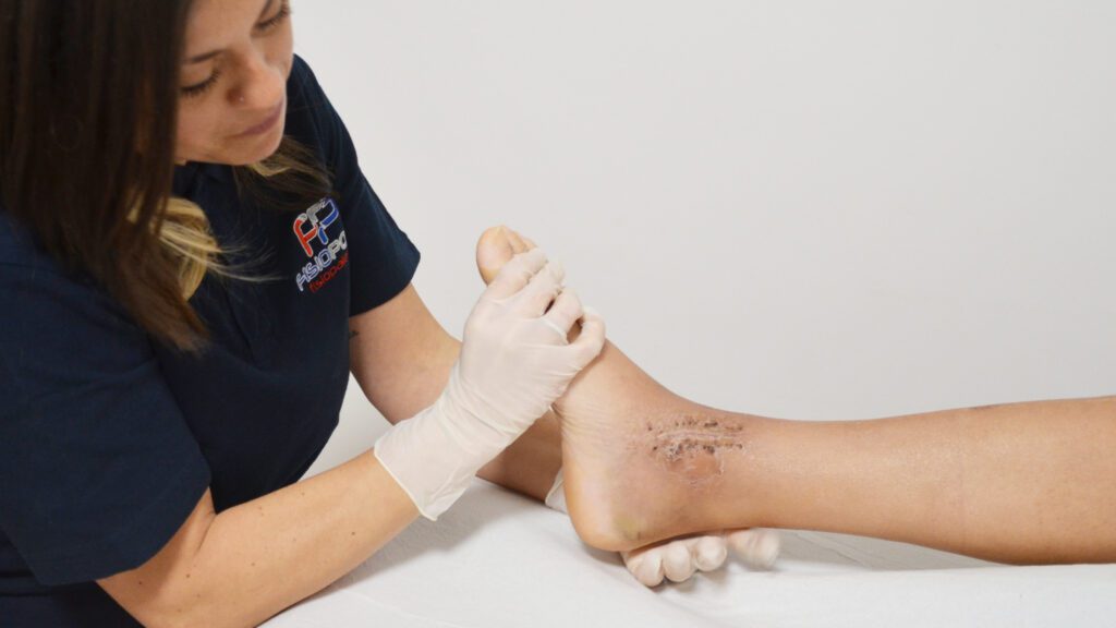 0122.FisioPoint_Frattura_caviglia