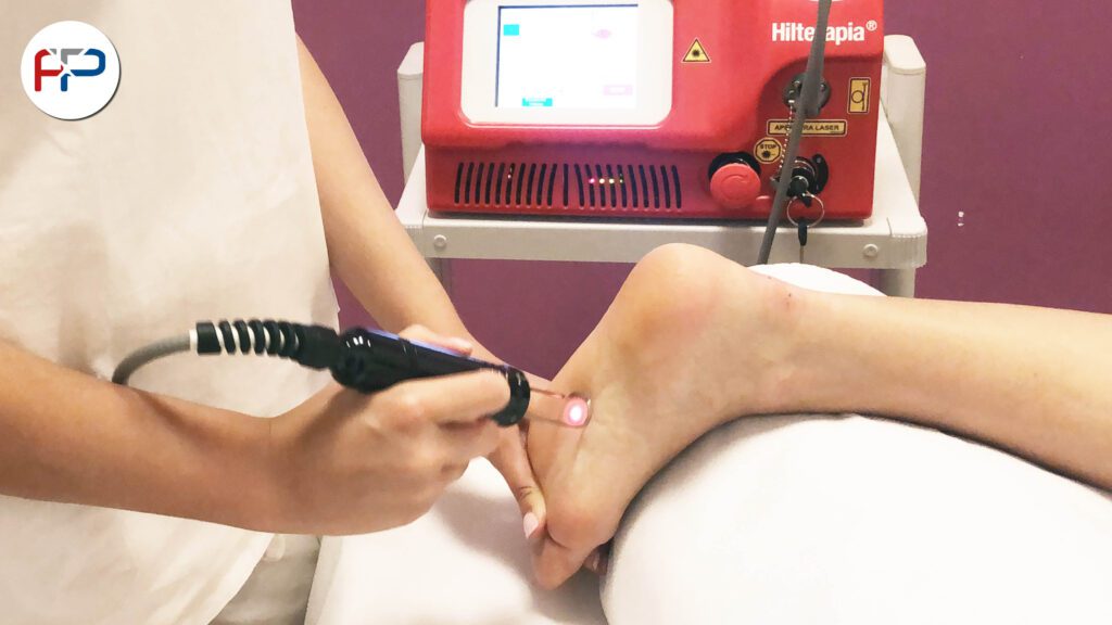 Fisio Point Centri di fisioterapia, poliambulatorio, diagnostica, risonanza magnetica a Roma e Grottaferrata, laserterapia fascite plantare