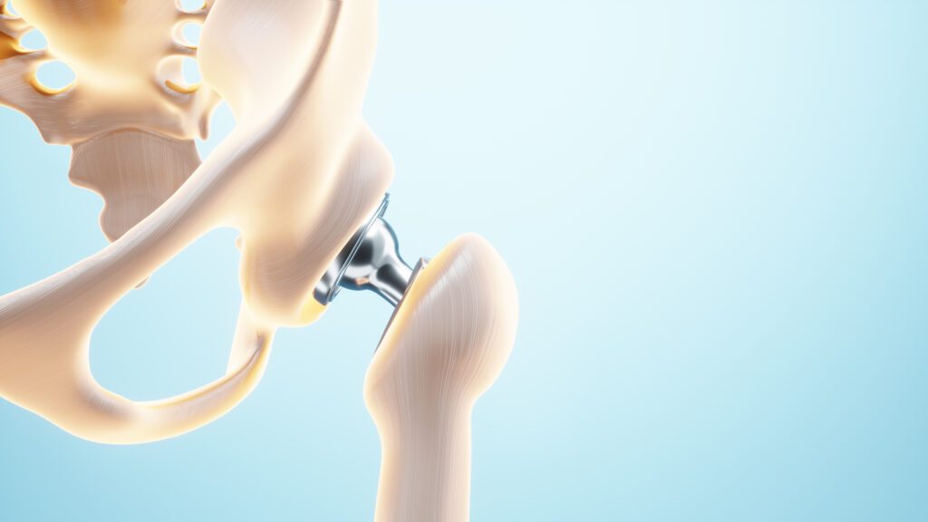 Fisio Point Centri di fisioterapia, poliambulatorio, diagnostica, risonanza magnetica a Roma e Grottaferrata,_protesianca_